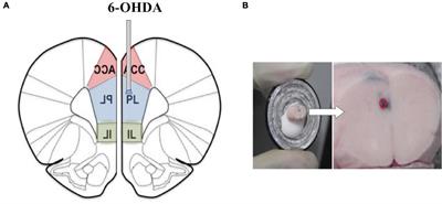 Effects of Chronic Social Defeat Stress on Behavior and Dopamine Receptors in Adolescent Mice With 6-Hydroxydopamine Lesions of the Medial Prefrontal Cortex